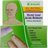 Olive Leaf Acne Remedy