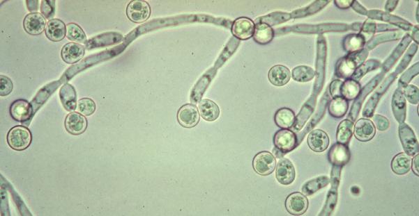 candida species image